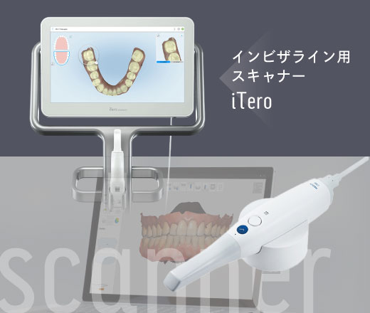 インビザライン用スキャナー「iTero」