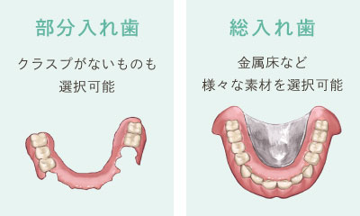 部分入れ歯（クラスプがないものも選択可能）　総入れ歯（金属床など様々な素材を選択可能）