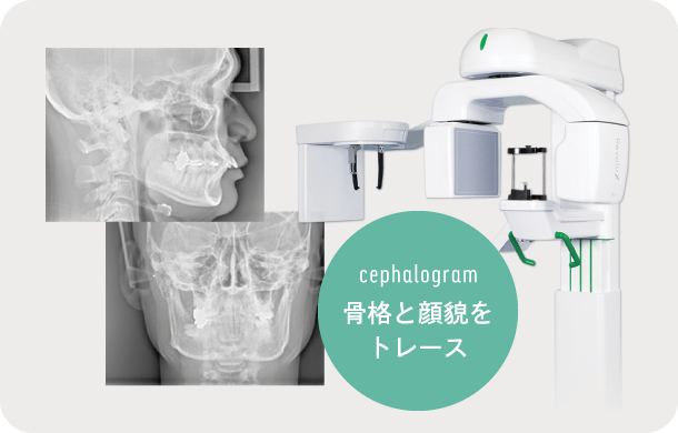 骨格と顔貌をトレース